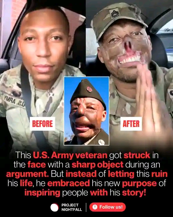 His Old Face Will Never Come Back Again